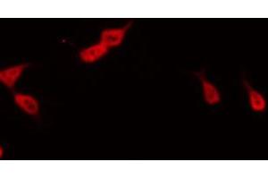 ABIN6267469 staining RAW264. (CDC25C antibody  (pSer216))