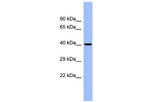 WB Suggested Anti-CEACAM6 Antibody Titration:  0. (CEACAM6 antibody  (N-Term))