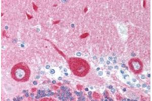 Human Brain, Cerebellum (formalin-fixed, paraffin-embedded) stained with FREQ antibody ABIN214036 at 5 ug/ml followed by biotinylated goat anti-rabbit IgG secondary antibody ABIN481713, alkaline phosphatase-streptavidin and chromogen. (NCS1 antibody)
