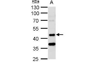 WB Image STK24 antibody [N2C1], Internal detects STK24 protein by western blot analysis. (STK24 antibody)