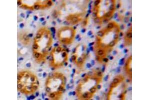 Used in DAB staining on fromalin fixed paraffin-embedded Kidney tissue (MOK antibody  (AA 2-228))