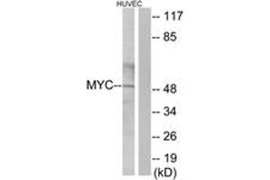 Western blot analysis of extracts from HuvEc cells, using MYC Antibody. (c-MYC antibody  (AA 386-435))