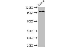 Western Blot Positive WB detected in: Mouse brain tissue All lanes: ABR antibody at 3. (ABR antibody  (AA 797-859))