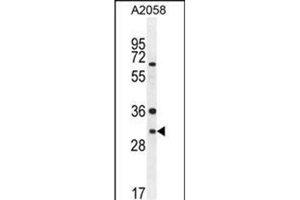 ARV1 anticorps  (N-Term)