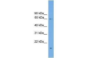Human MCF-7; WB Suggested Anti-ZNF320 Antibody Titration: 0. (ZNF320 antibody  (N-Term))