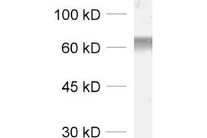 dilution: 1 : 1000, sample: synaptic vesicle fraction of rat brain (LP2) (GAD antibody  (AA 3-101))