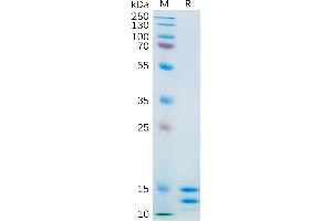 SDS-PAGE (SDS) image for Interleukin 2 (IL2) (AA 21-153) protein (His tag) (ABIN7092722)