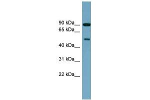 WB Suggested Anti-PI4K2B Antibody Titration: 0. (PI4K2B antibody  (Middle Region))