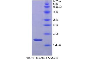 SDS-PAGE analysis of Mouse Gastrokine 3 Protein.