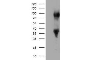 HEK293T cells were transfected with the pCMV6-ENTRY control (Left lane) or pCMV6-ENTRY ERCC1 (Right lane) cDNA for 48 hrs and lysed. (ERCC1 antibody)