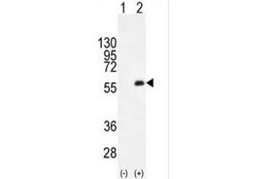 Western blot analysis of PKMYT1 (arrow) using rabbit polyclonal PKMYT1 C-term (ABIN391292 and ABIN2841332). (PKMYT1 antibody  (C-Term))