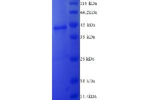 SDS-PAGE (SDS) image for Collagen, Type XVIII, alpha 1 (COL18A1) (AA 1578-1754) protein (His tag) (ABIN5713372) (COL18A1 Protein (AA 1578-1754) (His tag))