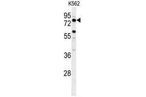 Western blot analysis of ACBG2 Antibody (Center) in K562 cell line lysates (35ug/lane). (ACSBG2 antibody  (Middle Region))