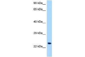 WB Suggested Anti-OSCAR Antibody Titration: 1.