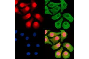 ABIN6263498 and ABIN6268752 staining Hela cells by IF/ICC. (MYCN antibody  (Internal Region))