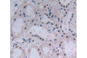 IHC-P analysis of Human Tissue, with DAB staining. (ATF3 antibody  (AA 1-181))
