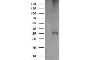 Western Blotting (WB) image for anti-T-cell surface glycoprotein CD1c (CD1C) antibody (ABIN1497187) (CD1c antibody)