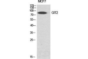 Western Blot (WB) analysis of specific cells using GIT2 Polyclonal Antibody.