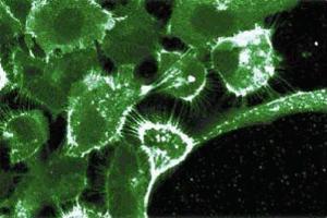 Immunofluroescent staining on A431 cells. (EGFR antibody  (AA 1020-1046))