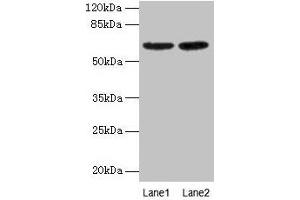 Western Blot All lanes: NELFB antibody at 2 μg/mL Lane 1: NIH/3T3 whole cell lysate Lane 2: HL60 whole cell lysate Secondary Goat polyclonal to rabbit IgG at 1/15000 dilution Predicted band size: 66 kDa Observed band size: 66 kDa (COBRA1 antibody  (AA 8-199))