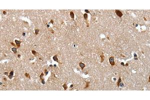 Immunohistochemistry of paraffin-embedded Human brain tissue using LAMA1 Polyclonal Antibody at dilution of 1:70 (Laminin alpha 1 antibody)