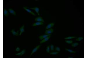 Detection of CASP9 in Human HepG2 cell using Polyclonal Antibody to Caspase 9 (CASP9) (Caspase 9 antibody  (AA 331-416))