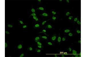 Immunofluorescence of monoclonal antibody to CMAS on HeLa cell.