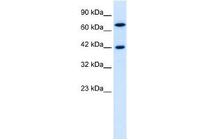 WB Suggested Anti-C20ORF100 Antibody Titration: 0. (TOX2 antibody  (N-Term))