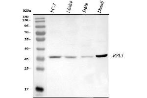 Western blot analysis of RPL5 using anti-RPL5 antibody (ABIN7601007).