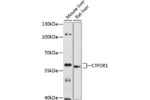 Western blot analysis of extracts of various cell lines, using CYP2R1 antibody (ABIN6130162, ABIN6139341, ABIN6139342 and ABIN6214739) at 1:1000 dilution. (CYP2R1 antibody  (AA 252-501))