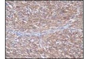 Immunohistochemistry (IHC) image for anti-Mast/stem Cell Growth Factor Receptor (KIT) (C-Term) antibody (ABIN870479) (KIT antibody  (C-Term))