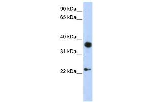 EN1 antibody used at 1 ug/ml to detect target protein. (EN1 antibody  (C-Term))