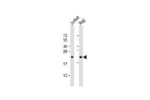 All lanes : Anti-CBFB Antibody (Center) at 1:1000 dilution Lane 1: Jurkat whole cell lysate Lane 2: Raji whole cell lysate Lysates/proteins at 20 μg per lane. (CBFB antibody  (AA 61-90))