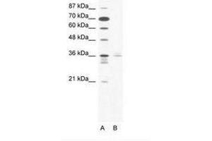Image no. 1 for anti-LIM Homeobox 3 (LHX3) (AA 230-279) antibody (ABIN203106) (LHX3 antibody  (AA 230-279))