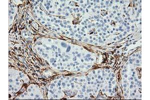 Image no. 4 for anti-Alcohol Dehydrogenase 1B (Class I), beta Polypeptide (ADH1B) antibody (ABIN1496479) (ADH1B antibody)