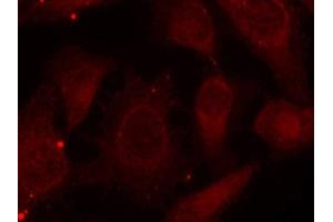 Immunofluorescence staining of methanol-fixed Hela cells using Phospho-NF2-S518 antibody. (Merlin antibody  (pSer518))