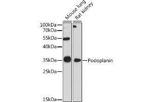 Western blot analysis of extracts of various cell lines, using Podoplanin antibody (ABIN6128559, ABIN6145406, ABIN6145409 and ABIN6217196) at 1:1000 dilution. (Podoplanin antibody)