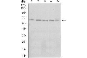 Western blot analysis using KBTBD8 mouse mAb against A431 (1), Jurkat (2), Hela (3), K562 (4), and HEK293 (5) cell lysate. (KBTBD8 antibody  (AA 264-464))