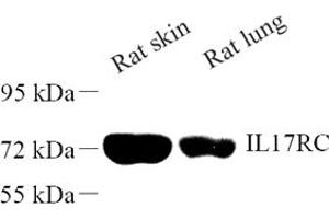 Western blot analysis of IL17RC (ABIN7074345) at dilution of 1: 500 (IL17RC antibody)