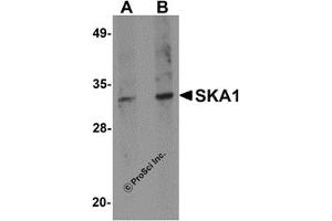 Western Blotting (WB) image for anti-Spindle and Kinetochore Associated Complex Subunit 1 (SKA1) (C-Term) antibody (ABIN1030667) (SKA1 antibody  (C-Term))