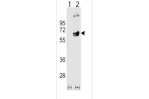 Western blot analysis of FYN using rabbit polyclonal FYN Antibody using 293 cell lysates (2 ug/lane) either nontransfected (Lane 1) or transiently transfected (Lane 2) with the FYN gene.