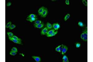 Immunofluorescent analysis of HepG2 cells using ABIN7176714 at dilution of 1:100 and Alexa Fluor 488-congugated AffiniPure Goat Anti-Rabbit IgG(H+L) (SLC39A8 antibody  (AA 30-132))