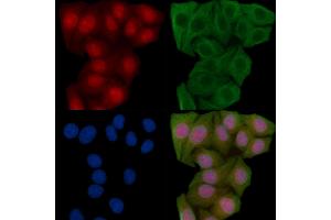 ABIN6265321 and ABIN6269248 staining Hela cells(45 min of heat-shock) by IF/ICC.