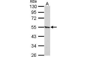 WB Image Retinoic Acid Receptor gamma antibody detects RARG protein by Western blot analysis. (Retinoic Acid Receptor gamma antibody)