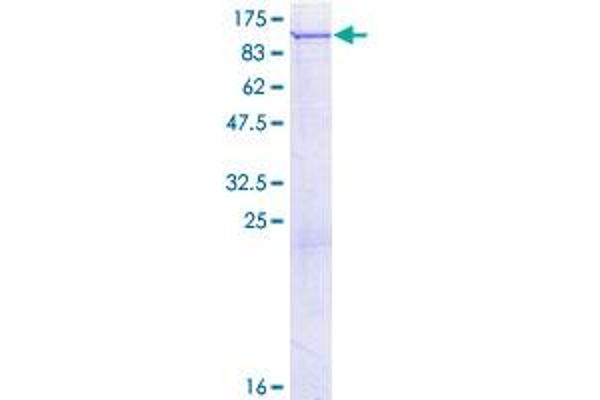 PLA2G6 Protein (AA 1-752) (GST tag)