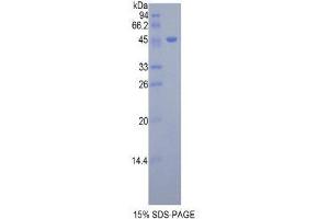 SDS-PAGE (SDS) image for Dermatopontin (DPT) (AA 29-197) protein (His tag,GST tag) (ABIN2122744)