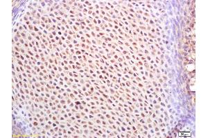 Formalin-fixed and paraffin embedded mouse embryo labeled with Rabbit Anti IGF2BP1/IMP1 Polyclonal Antibody, Unconjugated (ABIN1386018) at 1:200 followed by conjugation to the secondary antibody and DAB staining (IGF2BP1 antibody  (AA 31-130))