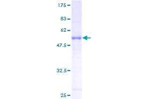 RAB34 Protein (AA 1-251) (GST tag)