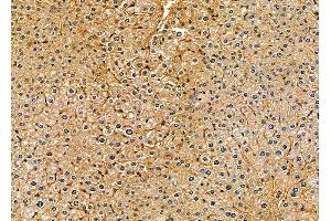 ABIN7094981 and ABIN7099037 at 1/100 staining mouse liver tissue by IHC-P.