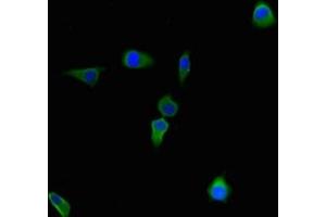 Immunofluorescent analysis of Hela cells using ABIN7148034 at dilution of 1:100 and Alexa Fluor 488-congugated AffiniPure Goat Anti-Rabbit IgG(H+L) (CBWD2 antibody  (AA 96-395))